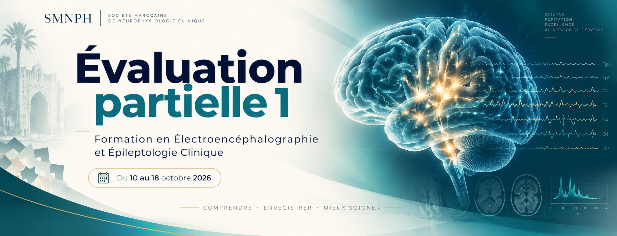 Évaluation partielle 1 — EEG & Épileptologie Clinique